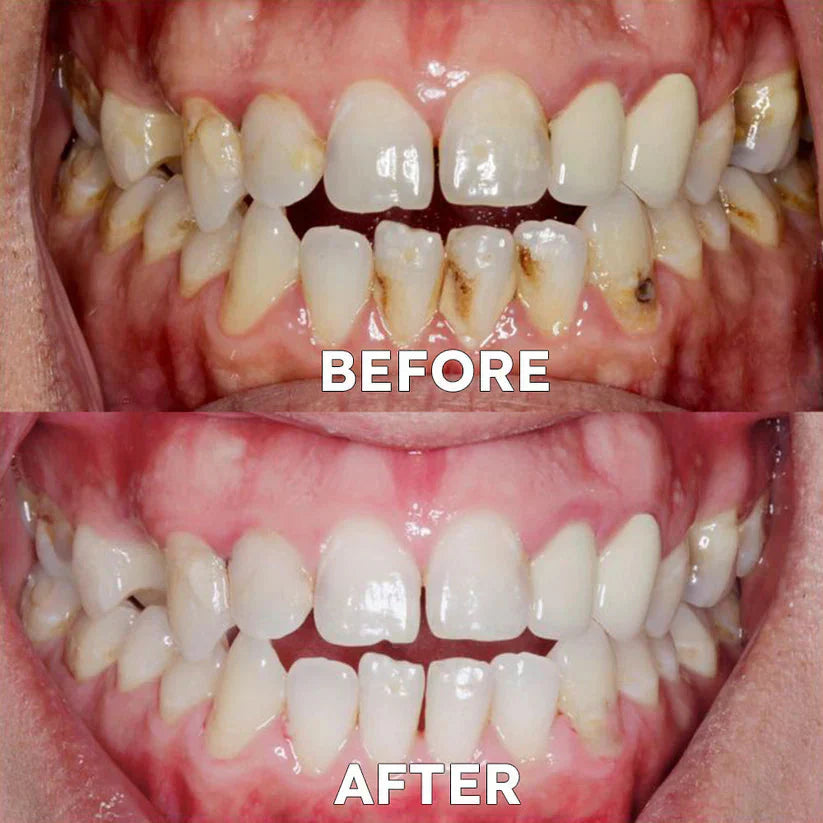 Ourlyard™ Tooth Powder