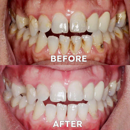 Ourlyard™ Tooth Powder